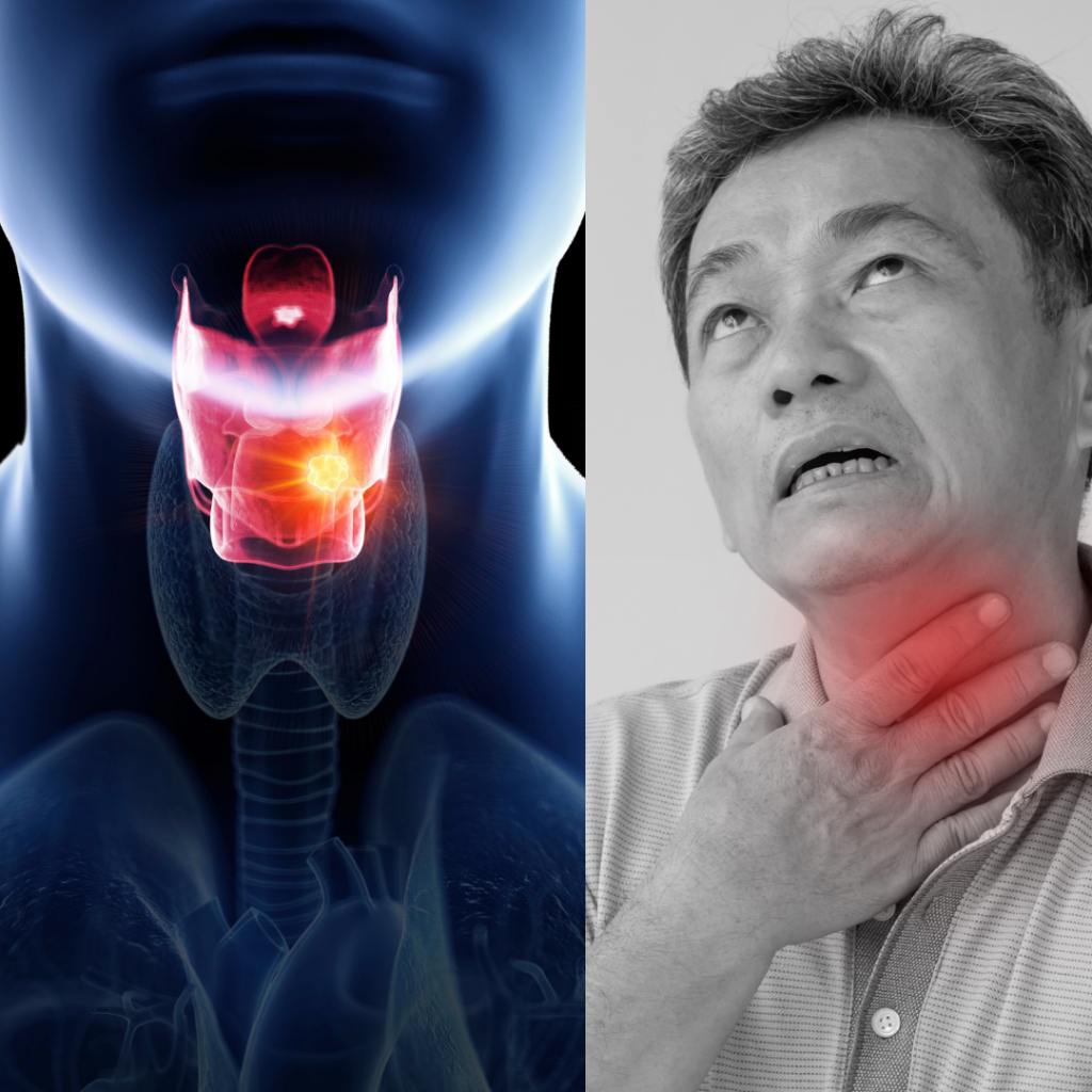 Micro Laryngeal cancer Surgery in ahmedabad