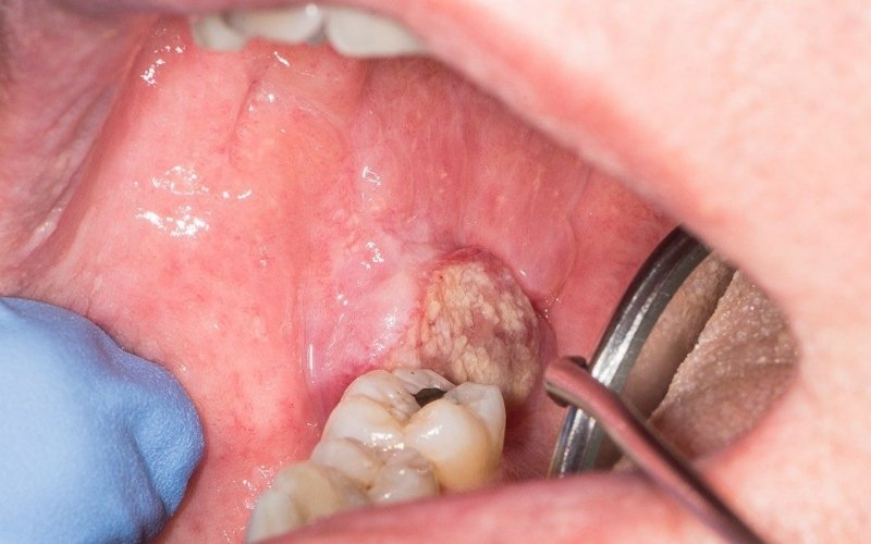 Oral Surgery slider