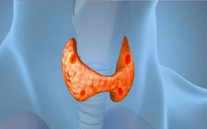 Thyroid surgery slider