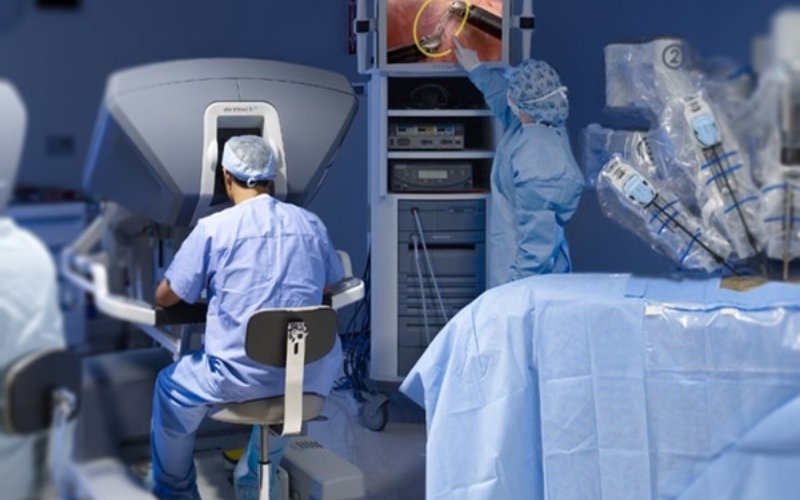 Transoral Robotic Surgery slider