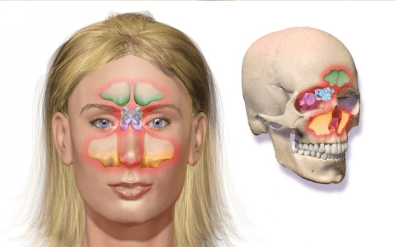 Sinonasal Cancer and Endo Nasal Cancer Surgery slider