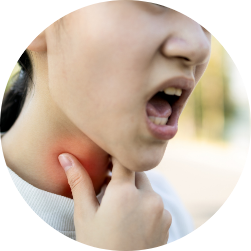 Persistent Hoarseness