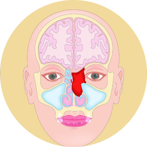 Tumor behind Nose