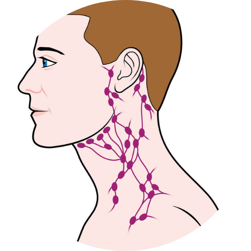 Tumor extending neck