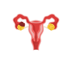 Ovary Image